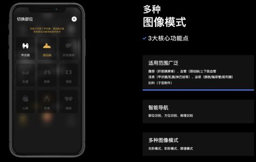 3年7輪融資，深至科技的超聲AI 資本熱潮下的硬核實力與軟件研發真章